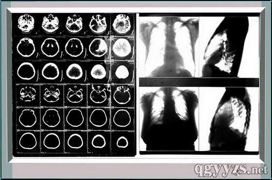 LEDҺ���t(y��)���^Ƭ�����^������a(ch��n)Ʒ�DƬ