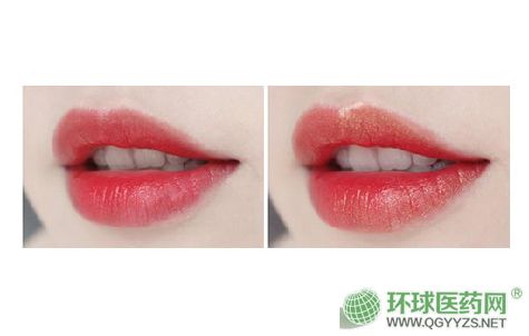 ����ˎ�I(y��)���F(tu��n)�����LUCK�ڼt�ۑ�ϵ���̽�t���a(ch��n)Ʒ�DƬ